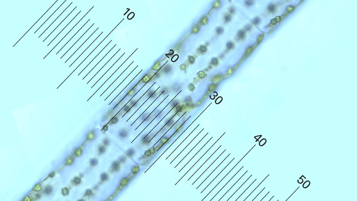 Microorganism Size Chart