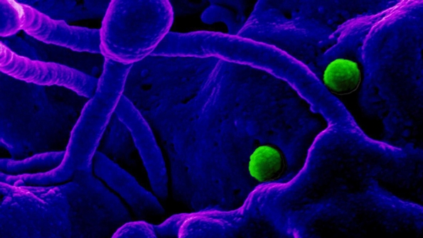 Microbes