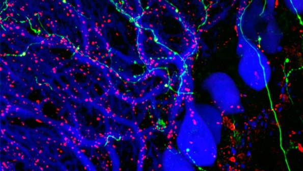 The Brain, Neurons and Brain Chemistry