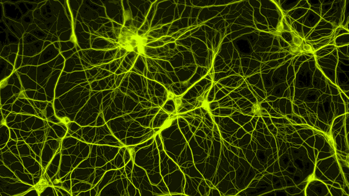 Neural Network Signals | BioEd Online