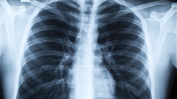 Respiratory System