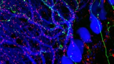 The Brain, Neurons and Brain Chemistry