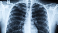 Overview of the Respiratory System