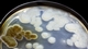 Microbes Are Everywhere